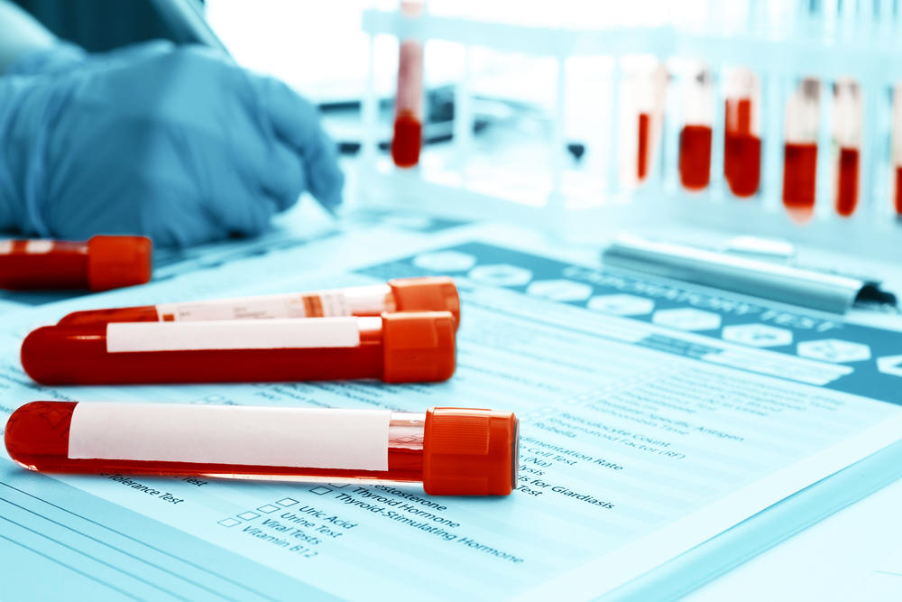 Inovação: Análises ao sangue podem vir a detetar cancro em pessoas ainda sem sintomas
